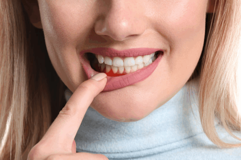 Gum Disease Symptoms and Treatment: Everything You Need to Know